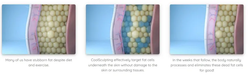 FrostFit Cryo in Newark, DE