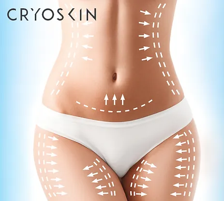 The CryoWellness Spa in Fishers, IN